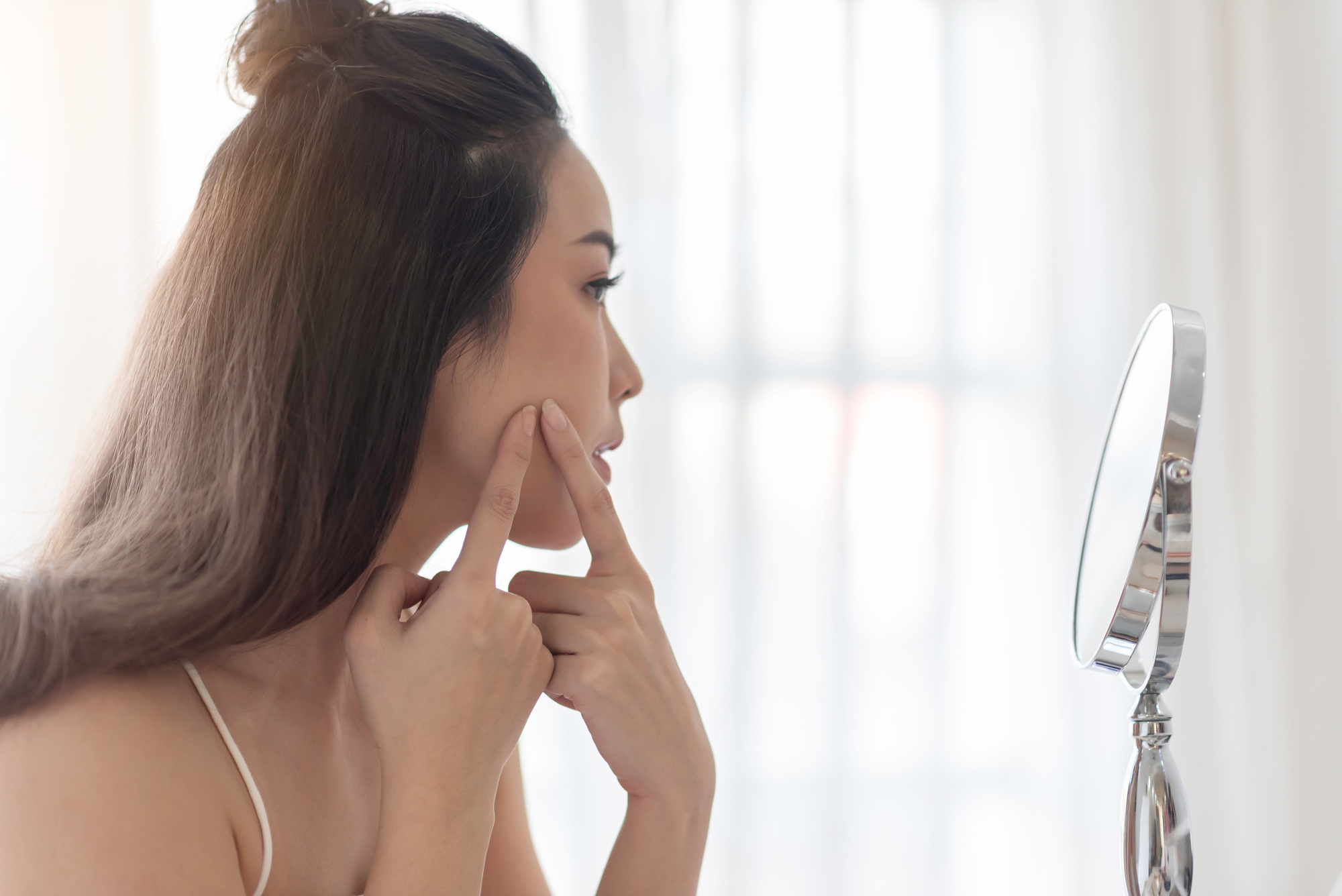 Worried Young girl of her acne.